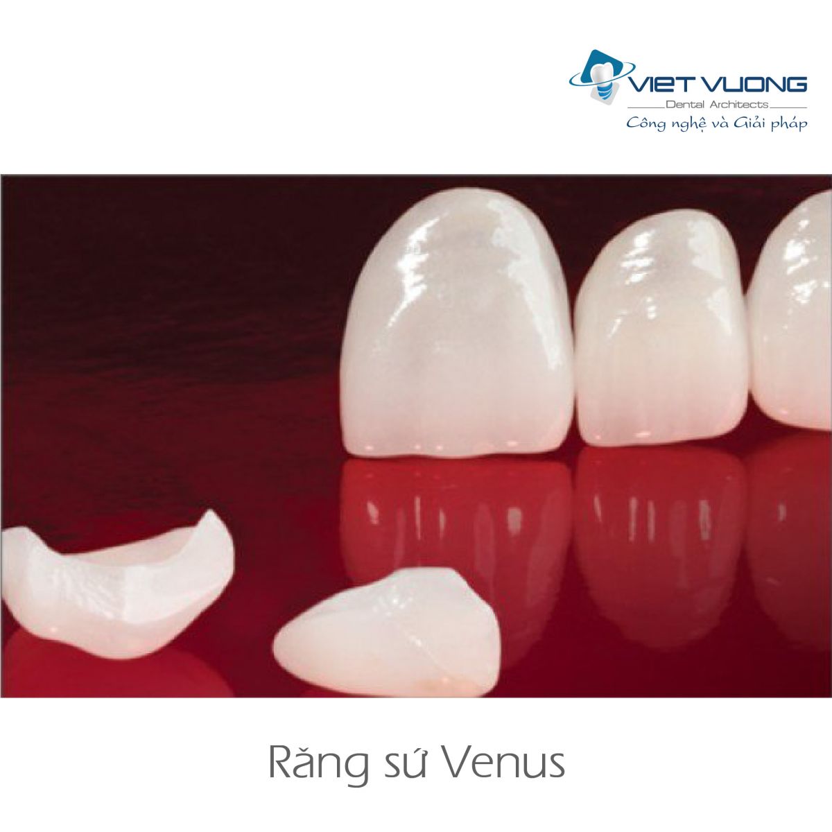 Răng sứ Zirconia – CAD/CAM VENUS