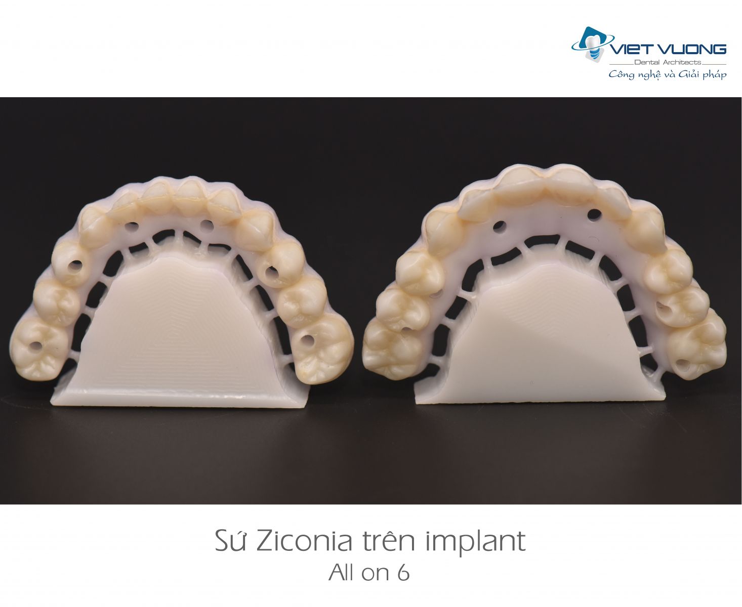 Sứ Zirconia trên Implant ( All-on-4,6,8 )